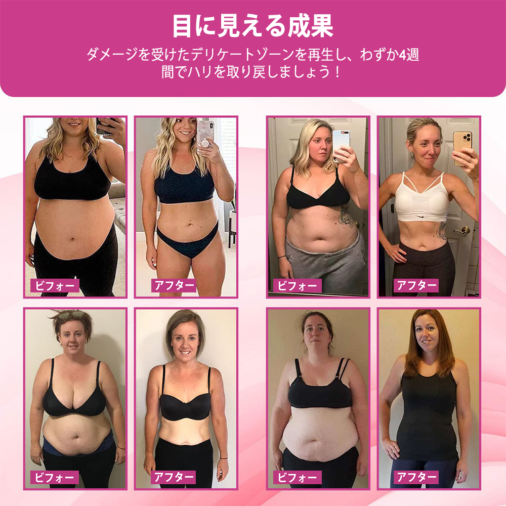🇯🇵キュラロナ® インスタントかゆみ止め＆デトックス🏥スリミング＆引き締め再生クリームとピンク＆ソフトナチュラルPROカプセル