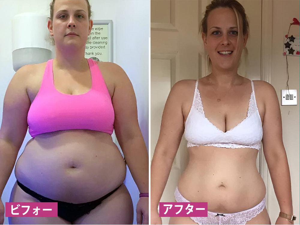 🇯🇵キュラロナ® インスタントかゆみ止め＆デトックス🏥スリミング＆引き締め再生クリームとピンク＆ソフトナチュラルPROカプセル