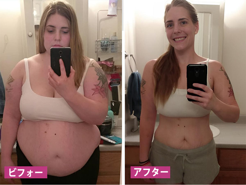 🇯🇵キュラロナ® インスタントかゆみ止め＆デトックス🏥スリミング＆引き締め再生クリームとピンク＆ソフトナチュラルPROカプセル
