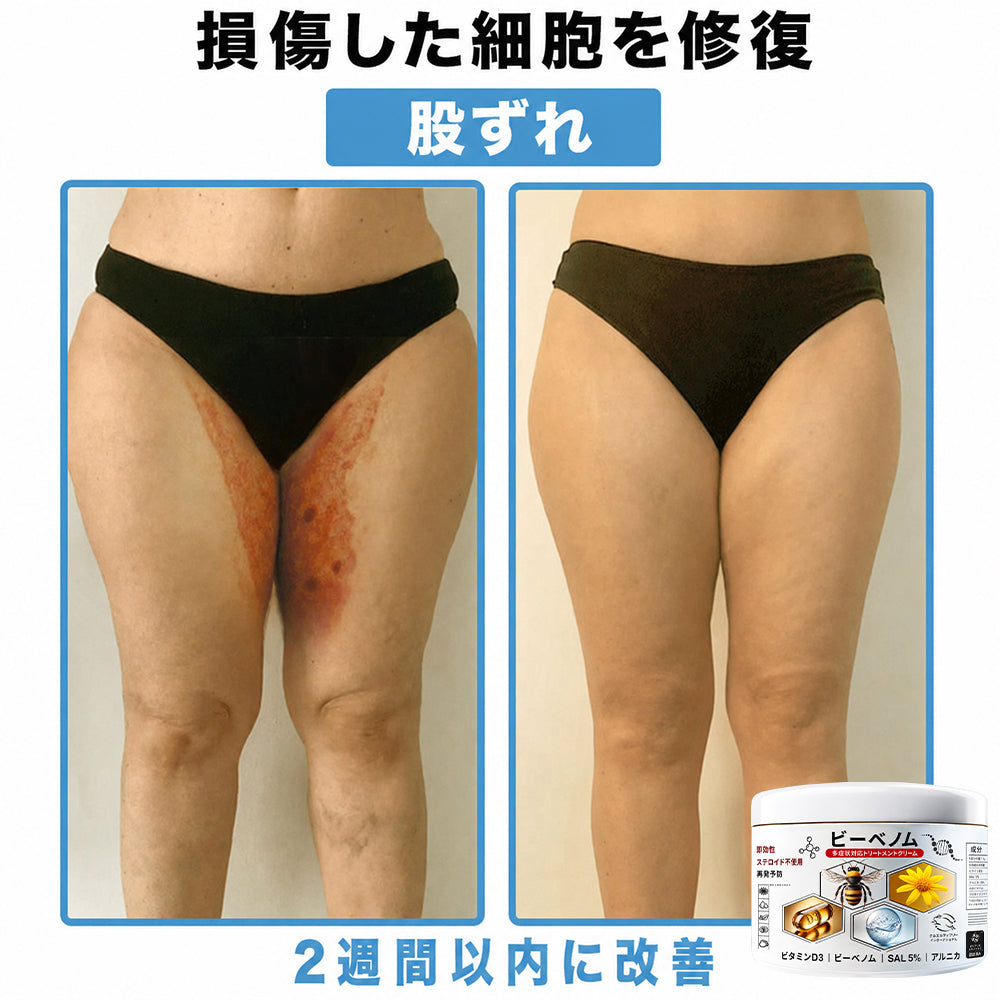 Purelora®💐 ビーベノム マルチシンптом スキントリートメントクリーム
