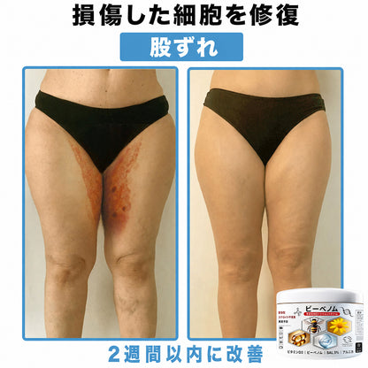 Purelora®💐 ビーベノム マルチシンптом スキントリートメントクリーム