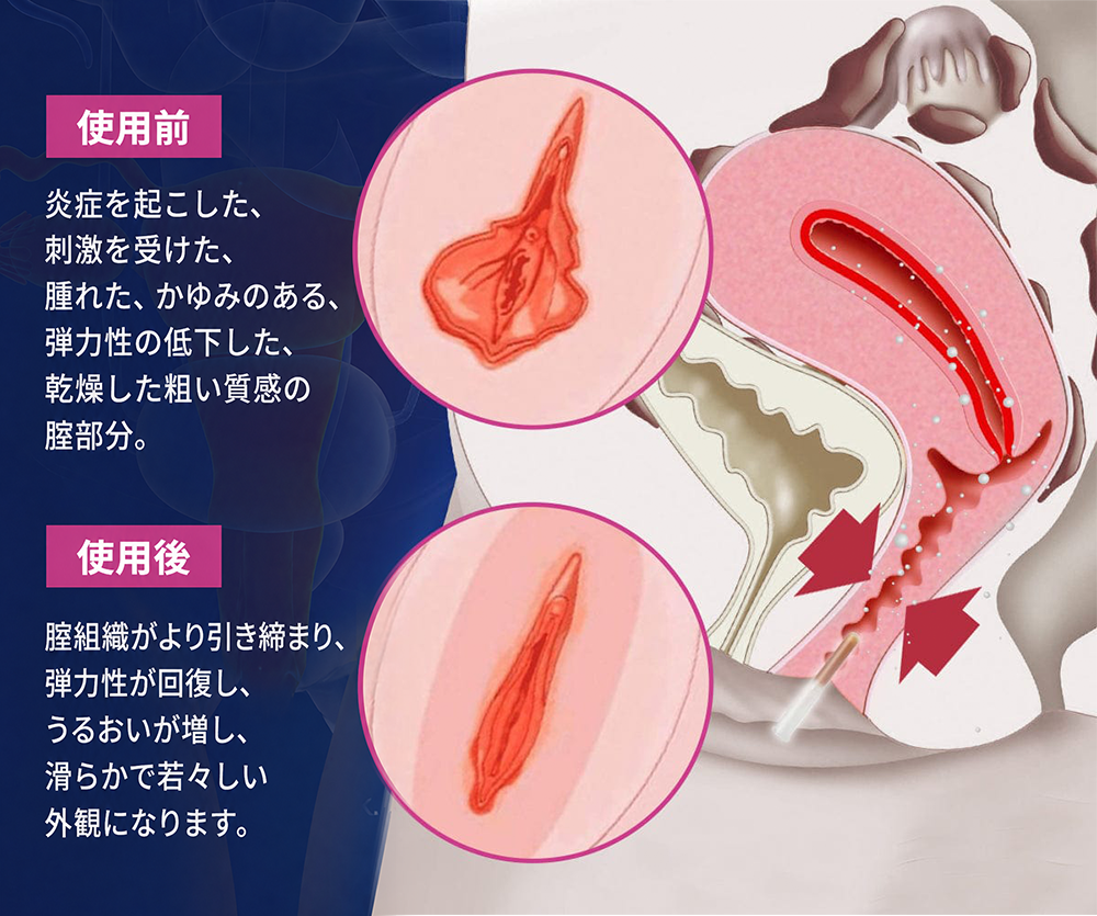 🇯🇵キュラロナ® インスタントかゆみ止め＆デトックス🏥スリミング＆引き締め再生クリームとピンク＆ソフトナチュラルPROカプセル