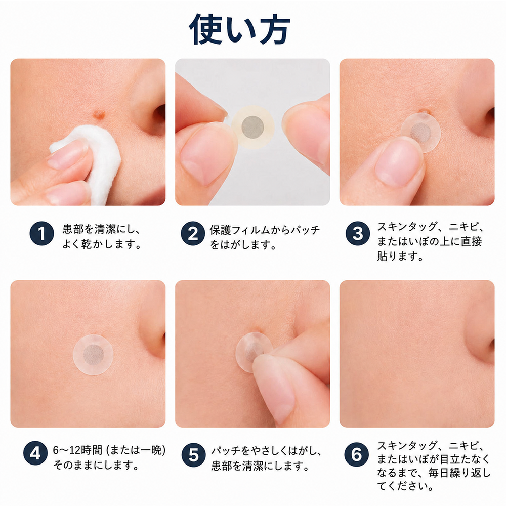✨Curalona® 2-in-1 マイクロニードル＆ハイドロコロイドパッチ🍀 | 隆起したほくろ、ニキビ、扁平イボ、皮膚線維腫を除去 | シワ、傷跡、肌の気になる部分の改善をサポート | 顔や体に使える目立たないパッチ