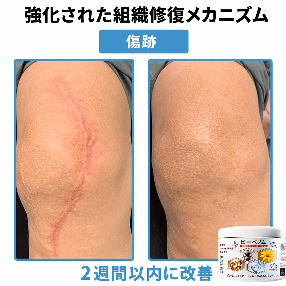 Purelora®💐 ビーベノム マルチシンптом スキントリートメントクリーム