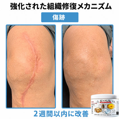 Purelora®💐 ビーベノム マルチシンптом スキントリートメントクリーム